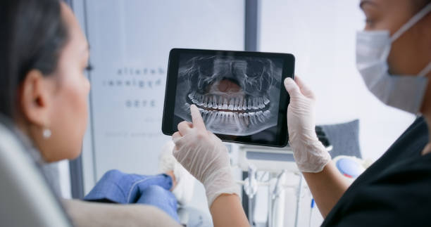 Licensed Wisdom Tooth Removal service in North Dakota, ND - Smile Center Dentistry